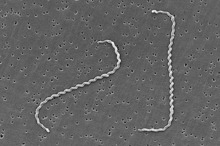 Leptospira interrogans strain RGA 01.png