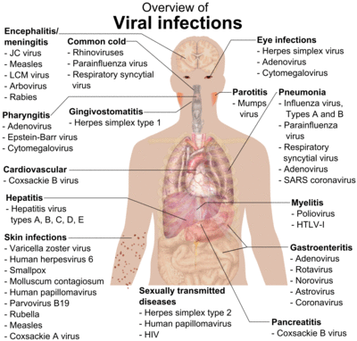 A photograph of the upper body of a man labelled with the names of viruses that infect the different parts