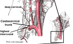 Costocervical trunk with branches.png