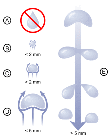 Diagram showing that very small rain drops are almost spherical in shape. As drops become larger, they become flattened on the bottom, like a hamburger bun. Very large rain drops are split into smaller ones by air resistance which makes them increasingly unstable.