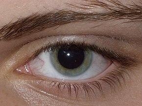 Result of Dilated fundus examination.JPG