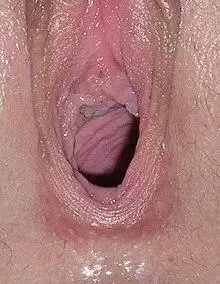 Close-up photograph of vagina