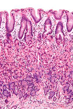 Normal gastric mucosa intermed mag.jpg