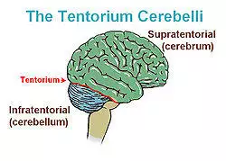 Illu tentorium.jpg
