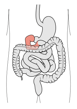 Tractus intestinalis duodenum.svg
