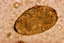 Paragonimus westermani 01.jpg