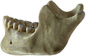 Human jawbone left.jpg