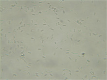 Phoma spores 160X.png