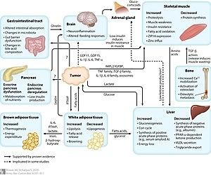 Cancer-associated cachexia diagram.jpg
