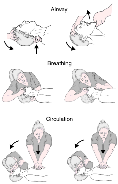 CPR | definition of CPR by Medical dictionary