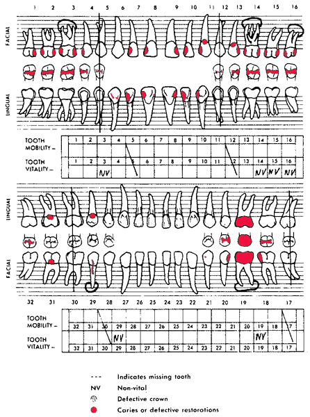Dental chart | definition of dental chart by Medical dictionary