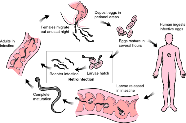 enterobius vermicularis ova