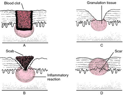 Wound healing process definition of Wound healing process by