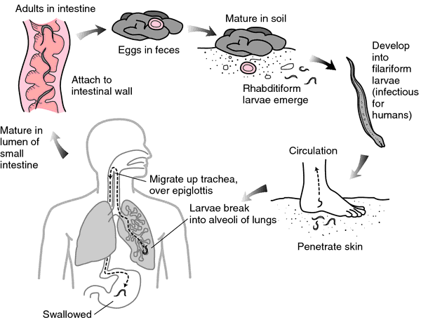 hookworm infection