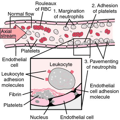 Exudative inflammation | definition of exudative inflammation by ...