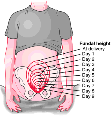 Bovine uterine prolapse - Wikipedia