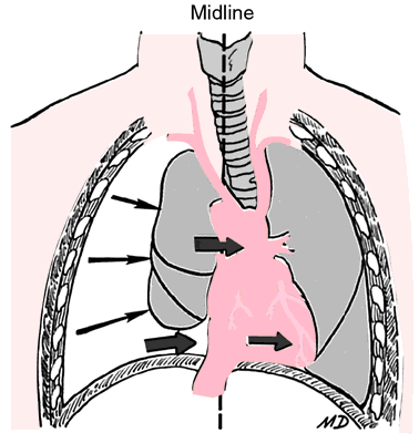 What is the Mediastinum?