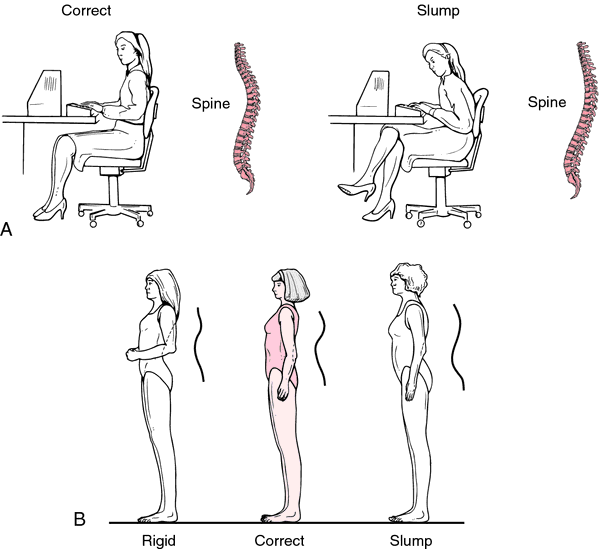 Posture definition of posture by Medical dictionary