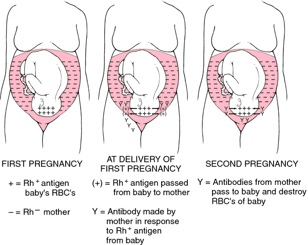 pregnancy-a-negative-blood-type-bingergene