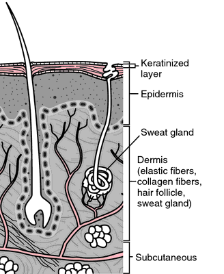 Fetid sweat definition of fetid sweat by Medical dictionary