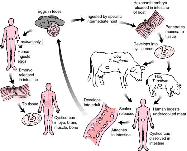 tapeworm causes