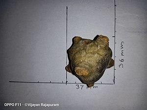 Urinary Bladder stone 04.jpg
