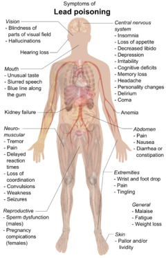 A chart of a human body with arrows pointing pieces of text to different parts of the body