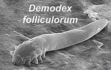 Demodex folliculorum SEM crop.jpg