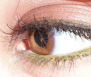 Persistent Pupillary Membrane - Fireinthexdisco.jpg